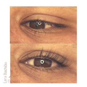 LASH LIFTING (LIFTING DOS CíLIOS)